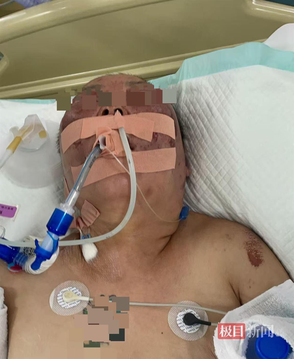 开云APP-被前夫打进ICU的女子情况仍不稳定，其8岁女儿也曾遭父亲扇脸，律师：已构成故意伤害罪，或同时涉虐待罪